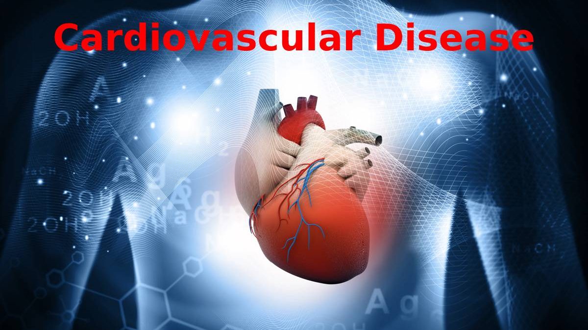 Cardiovascular Disease or Illnesses – Facts, Risk Factors, Symptoms 2022