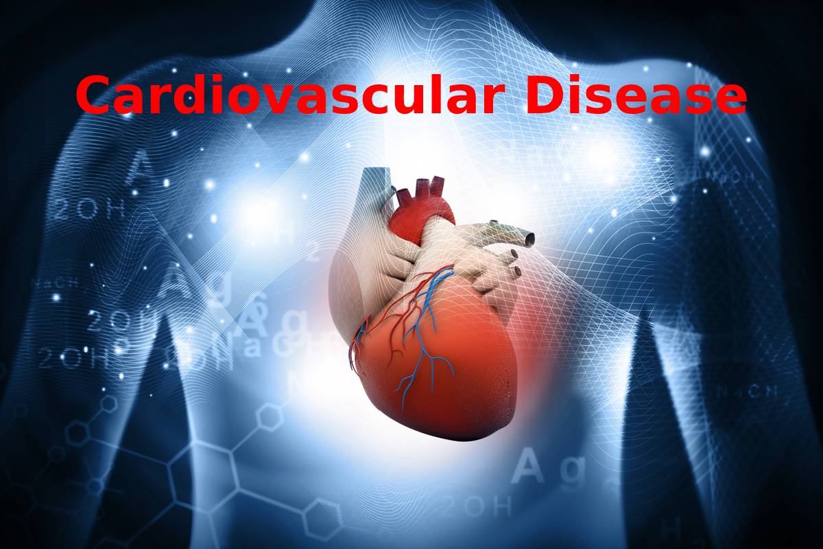 Cardiovascular Disease or Illnesses – Facts, Risk Factors, Symptoms 2022