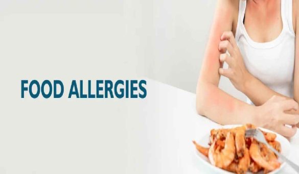 What are Food Allergy_ Symptoms & Treatment